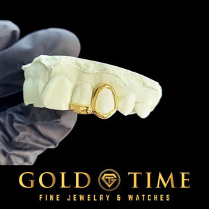 Yellow gold open face canine cap with a solid tip on the incisor beside it, fitted to a dental mold