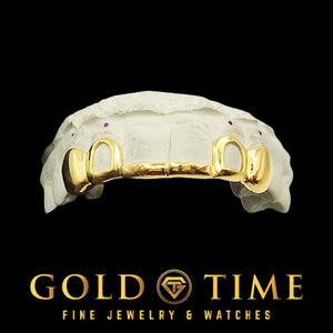 Front view of custom 6 piece yellow gold tip bar grillz