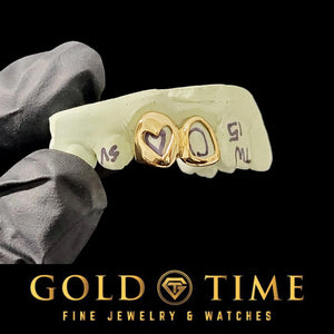 Front view of the gold heart cut out open face caps on a marked dental mold held in a gloved hand, Gold Time