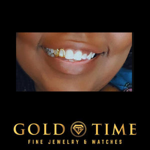 Gold heart cut out double cap grillz worn in a smile, Gold Time