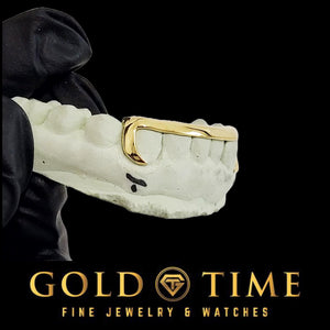 Side angle of the yellow gold J-hook canine and solid tip grill on a mold