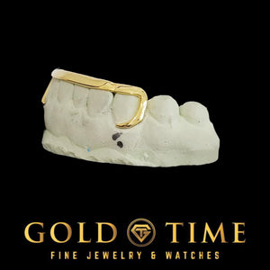 Close side view of the yellow gold J-hook canine outline wrapping the tooth