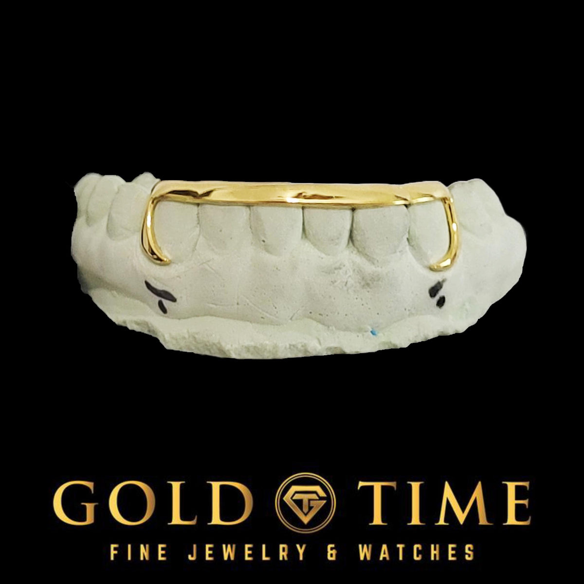 Custom 6-Piece Grillz with Solid Tips & J-Hook Canines  Gold, Silver, or 10k/14k Options  Includes Impression Kit  Fully Customizable