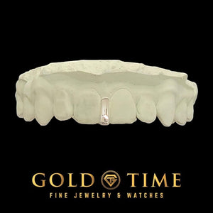 Single white gold or silver gap grill filling the space between the two front teeth on a dental mold