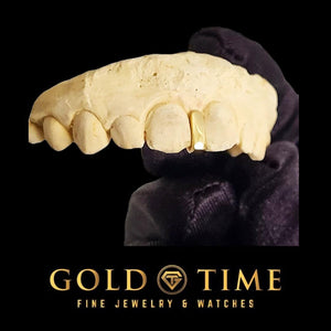 Yellow gold single gap grill set between two front teeth on a customer mold