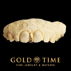 Close view of a polished yellow gold gap bar filling a front tooth gap