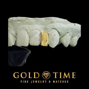 Wider yellow gold gap piece filling the space between the front teeth