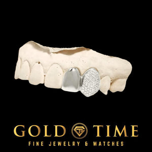 Close up of the iced incisor cap next to the solid gold canine cap fitted to a mold