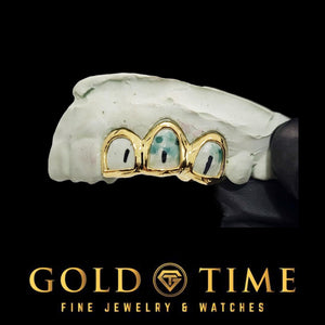Yellow gold open face triple cap grillz on a marked dental mold, Gold Time