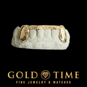 Yellow gold grillz with solid canines and a trillion diamond-cut tip bar on a mold