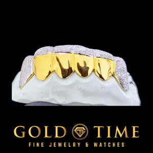12-piece diamond dust grillz detail close-up