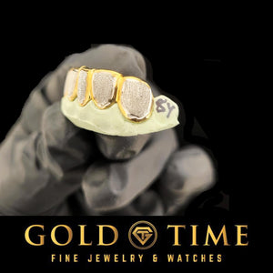 Side angle of the two-tone diamond dust box grillz showing the yellow gold frame edges