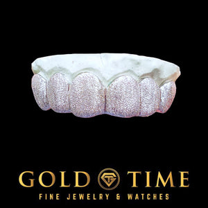 Rose gold 6 piece diamond dust grillz fitted to a dental mold