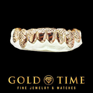 Rose gold trillion cut grillz shown on the lower teeth of a dental model