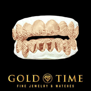 Rose gold 16 piece trillion cut grillz set viewed from the front on dental models
