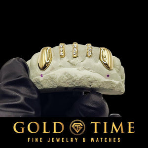 5 piece yellow gold grillz with two solid canines and three moissanite gap bars on a mold
