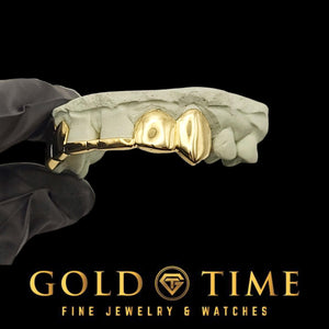 Close view of the polished incisor caps and pointed canines in yellow gold