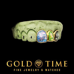 Galaxy enamel grillz caps in blue and green tones set in gold frames on a dental mold