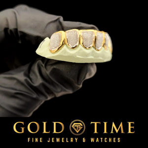 Gloved hand holding six two-tone box grillz with yellow frames and sparkling white dust centers