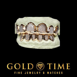 Angled view of the twelve piece two-tone diamond dust grillz set on molds