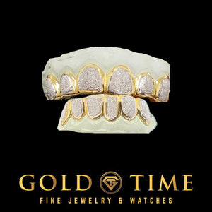 Twelve piece two-tone diamond dust box grillz set, full top and bottom, on dental molds