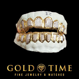 Open view of the full twelve piece two-tone diamond dust box grillz set, top and bottom rows
