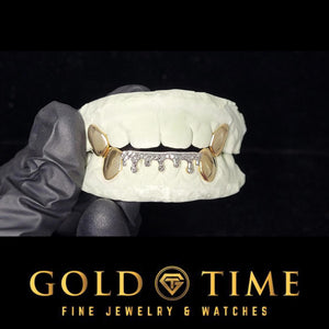Custom 8 piece two-tone grillz with solid yellow top canines and a white trillion drip bottom on a dental mold
