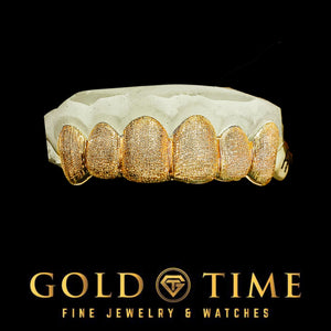 Yellow gold 6 piece diamond dust grillz showing the frosted cut texture across each cap