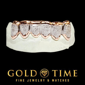 Two-tone rose and white diamond dust box grillz on a top mold, shown as a custom color example