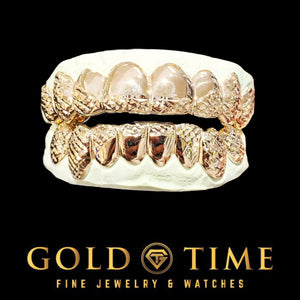 Rose gold 16 piece trillion cut grillz set shown on top and bottom dental models with the Gold Time logo