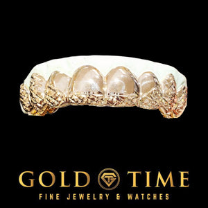 Close up of the upper half of the two tone trillion cut grillz set on a dental model