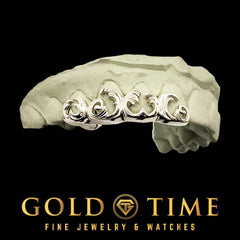 4-Piece Custom Grillz with 3D Wave Design  Silver or Gold Teeth Set  Handmade & Customizable with Impression Kit Included