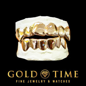 Solid yellow gold top and bottom grillz with a high polish finish on dental molds
