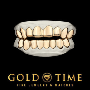 Custom solid yellow gold grillz set, top and bottom, fitted on dental molds