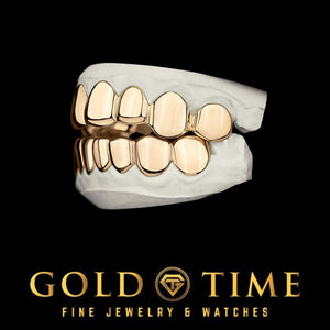 Rose gold solid grillz set, top and bottom, on dental molds