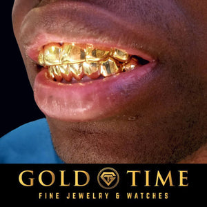 Close-up of a man wearing a custom solid gold grillz set on his top and bottom teeth