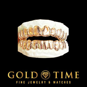 Rose gold top and bottom solid perm cut grillz on dental molds