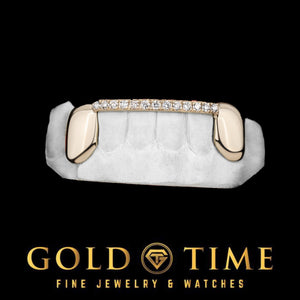 Close view of the white gold moissanite tip bar between two solid canine caps