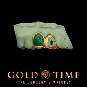 Close view of the green enamel inlay on the incisor cap next to the open face canine frame