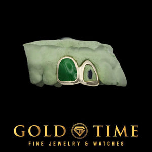Front view of the jade tone green incisor cap paired with an open face canine cap in yellow gold