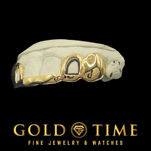 Custom 6 piece yellow gold tip bar grillz, side angle