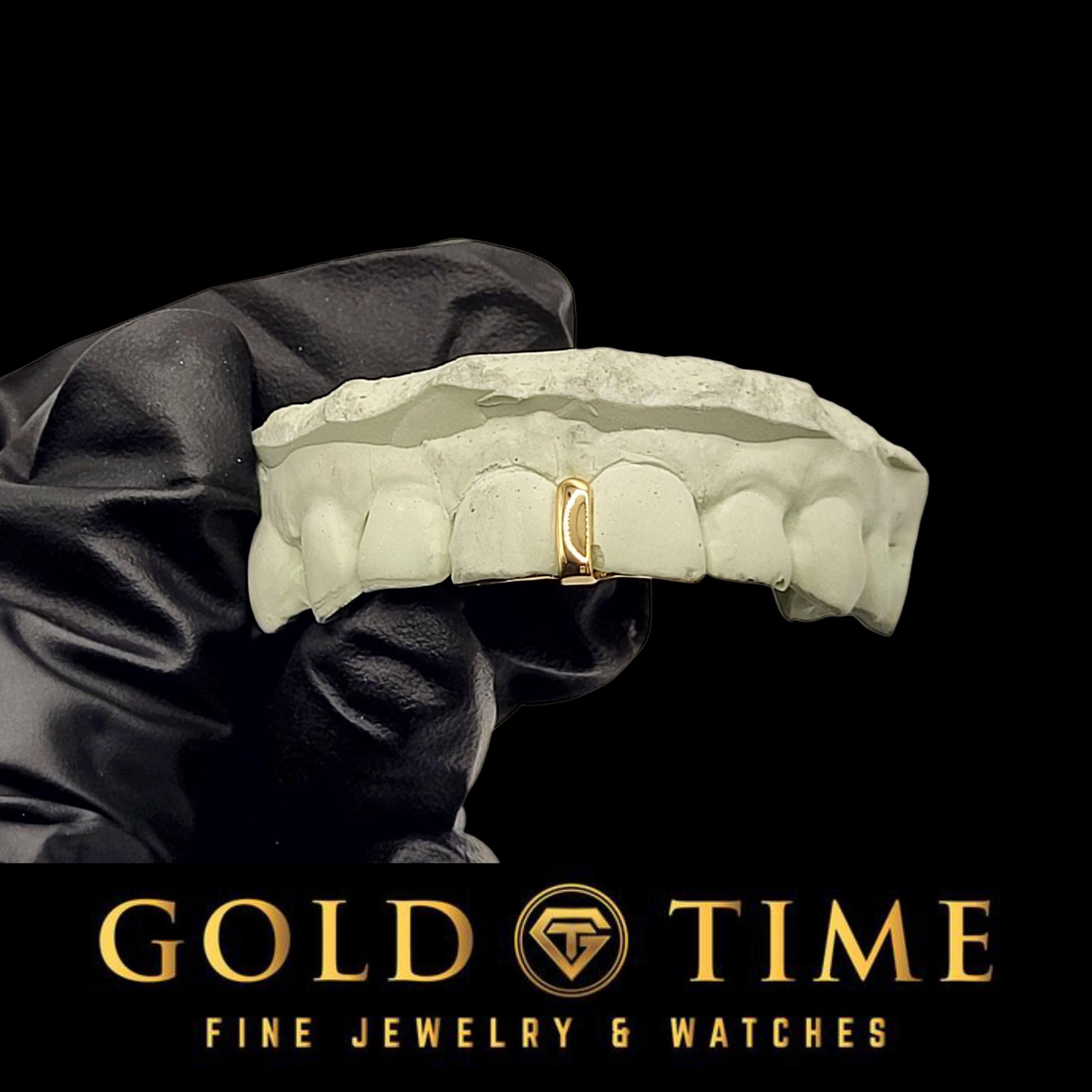 Custom Single Gap Grillz: Gold or Silver Tooth Bar with Mold Kit