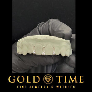 Custom silver gap bar grillz, 3 gap bars between top teeth on a mold