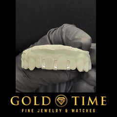 Custom Gap Bar Grillz  3 Gap Bar Gold or Silver Grillz | Made to Order Grillz with Free Impression Kit | Available in 10k, 14k, or Plated