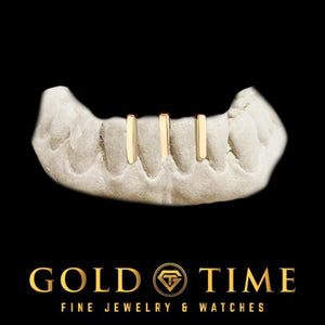 Custom yellow gold 3 gap bar grillz on bottom teeth