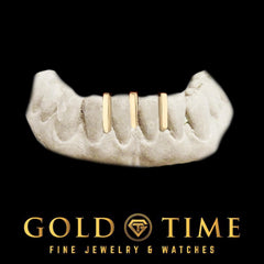 Custom Gap Bar Grillz  3 Gap Bar Gold or Silver Grillz | Made to Order Grillz with Free Impression Kit | Available in 10k, 14k, or Plated