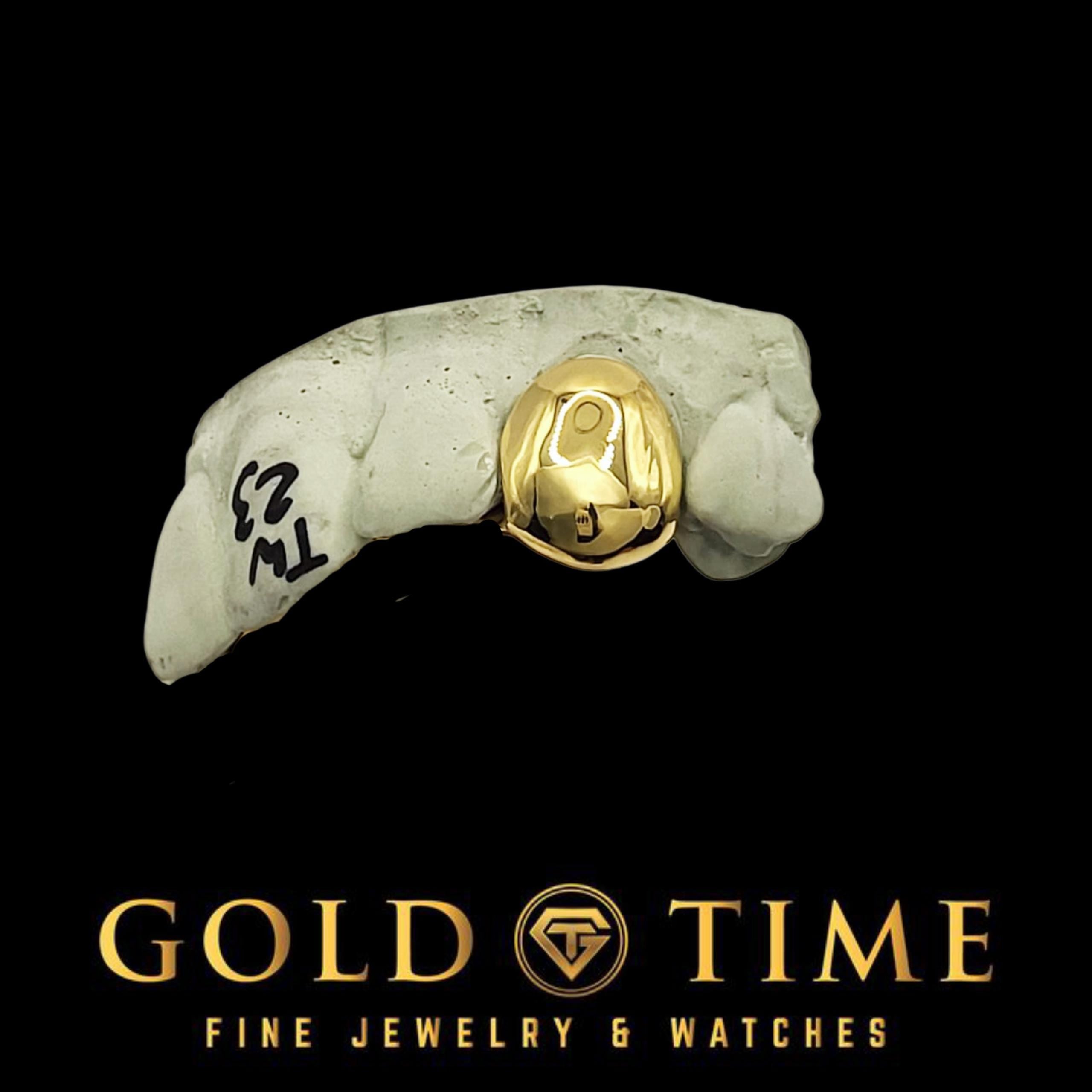 Custom Single Tooth Grillz: Handmade Solid Cap, Mold Kit Included