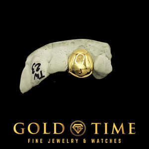 Angled view of a solid yellow gold single tooth cap on a dental mold
