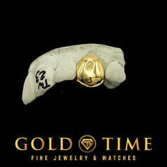 Custom Single Tooth Grillz: Handmade Solid Cap, Mold Kit Included