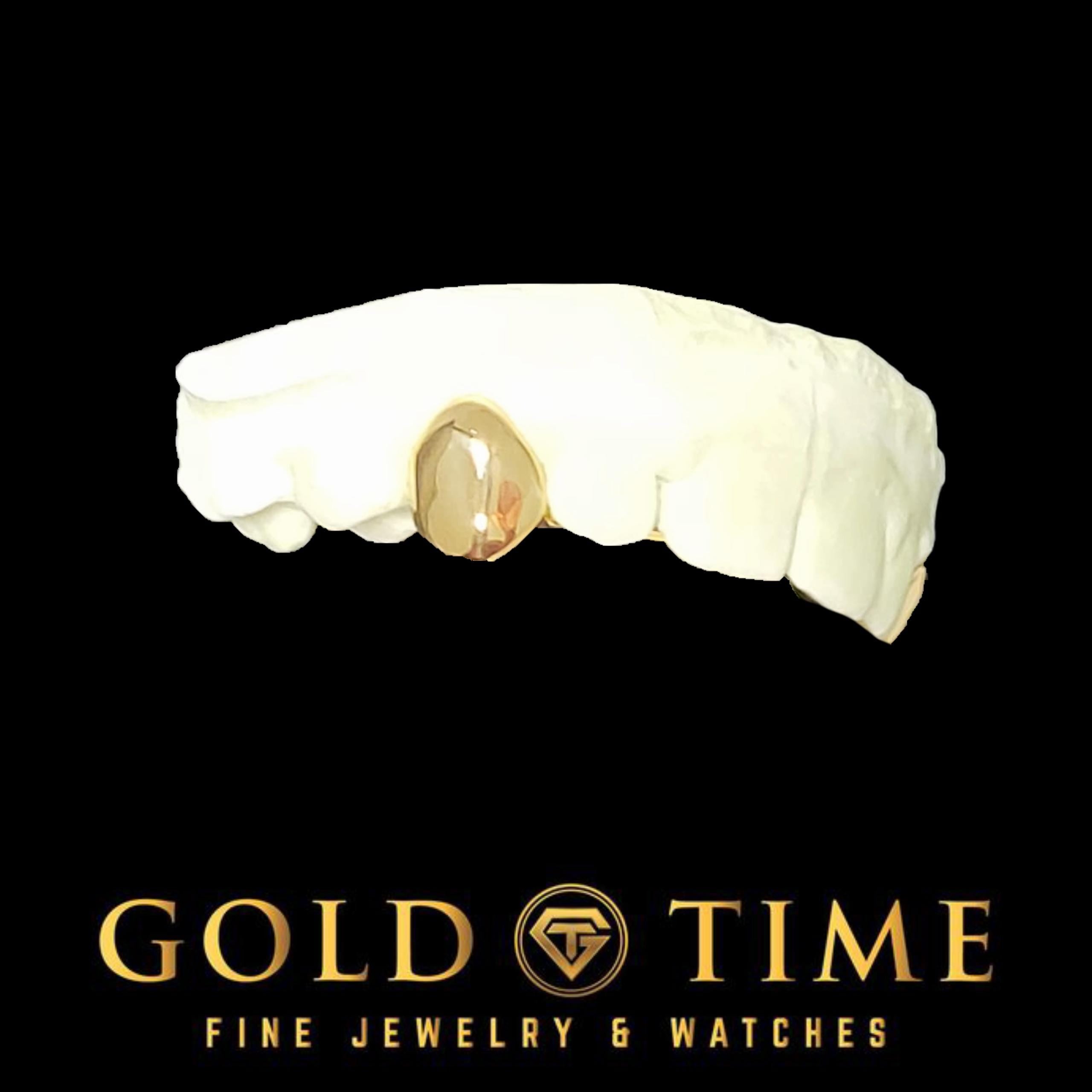 Custom Single Tooth Grillz: Handmade Solid Cap, Mold Kit Included